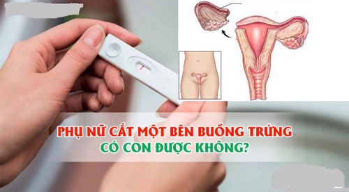 Phụ nữ cắt một bên buồng trứng có con được không? 